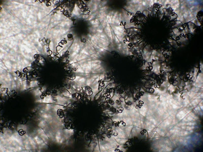 Microscopic view of dark, round fungal spores with curly filamentous structures that needs a mold inspection service.